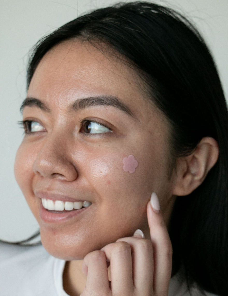 The Truth About Picking Pimples: Why It Makes Breakouts Worse