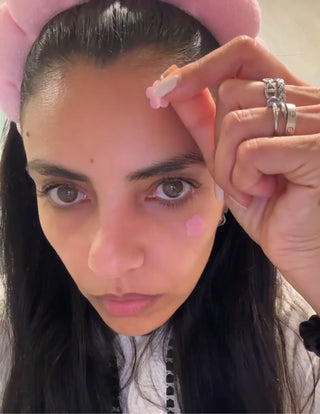 Are hydrocolloid patches good for acne-prone dry skin in winter?