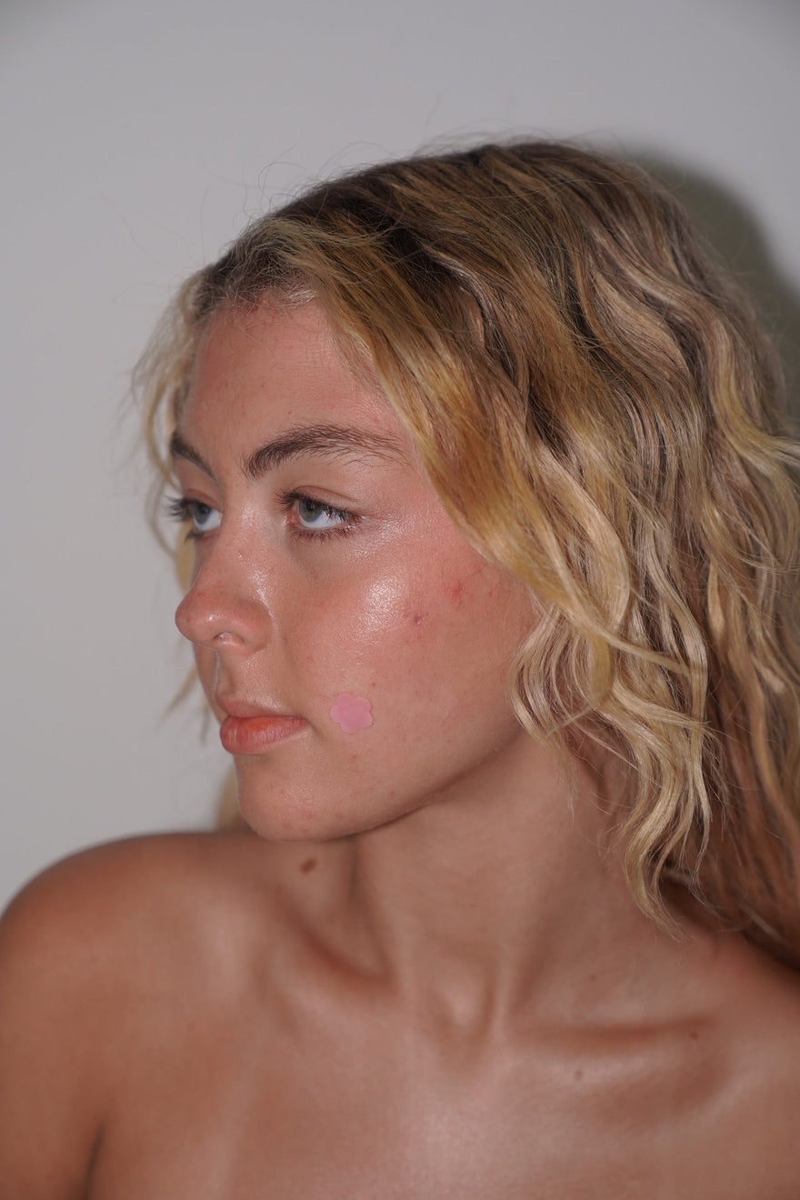 girl with bloomie pimple patch on cheek