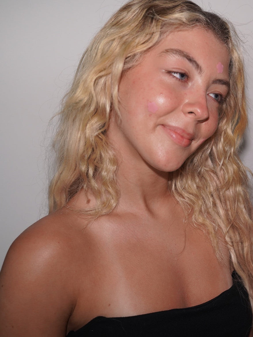 girl with bloomies pimple patch on cheek